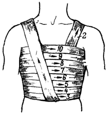 Спиральная повязка груди.