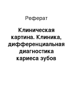 Реферат: Клиническая картина. Клиника, дифференциальная диагностика кариеса зубов