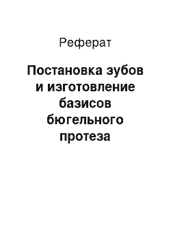 Реферат: Постановка зубов и изготовление базисов бюгельного протеза